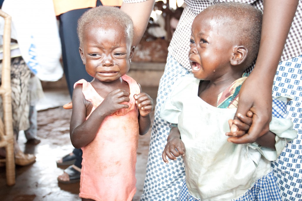 Bambini malnutriti sostenuti dai nostri benefattori a Wamba, RDC.